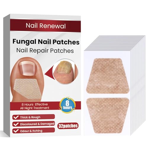 Fungus Nail Treatment, Nail Fungal, Fungi Nail, Antifungal, Antibacterial, BEST Antifungal Antibacterial Treatment, Kill bacterial