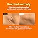 MEDITHERAPY Retinal Skin Booster Serum – Beginner-Friendly, Anti-Aging, Non-Irritating Retinol for Face and Body – Pore Minimizer, Wrinkle Treatment – Korean Skin Care, 5.07 Fl. Oz Large Size