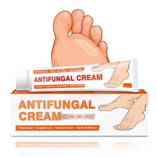 Cream Antimicotica 20g, Crema Hongos Pies, Natural y Suave, Cuida Pies Secos y Agrietados, Alivio Rápido de Picazón y Sensación de Comodidad