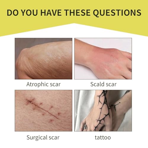 image for Bzjslt Tattoo Cover Up Patch, Tattoo Cover Up Tape, Ultra Thin Patch f