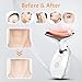 Yolopim 7 Color Face and Neck Massager for Skin Care, Multifunctional Facial Tool With Non-Slip Design, White