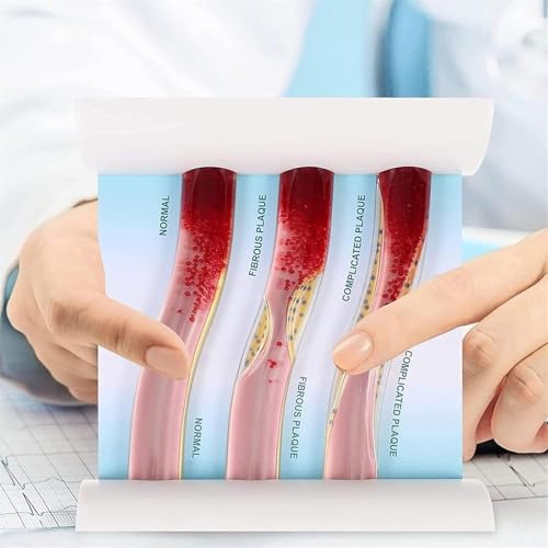 Human Blood Vessel Model Anatomy Model, LDL Blood Vessel Model, Teaching Tool to Promote Learning and Improve Understanding