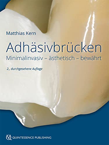 Adhäsivbrücken: Minimalinvasiv - ästhetisch - bewährt