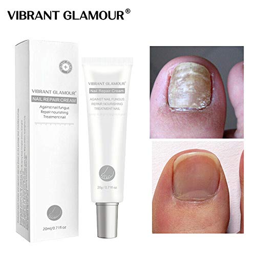 image for TTXS Vibrant Glamour Nail Care Nail Repair Cream Nail Fungus Treatment
