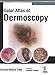 Colour Atlas of Dermoscopy