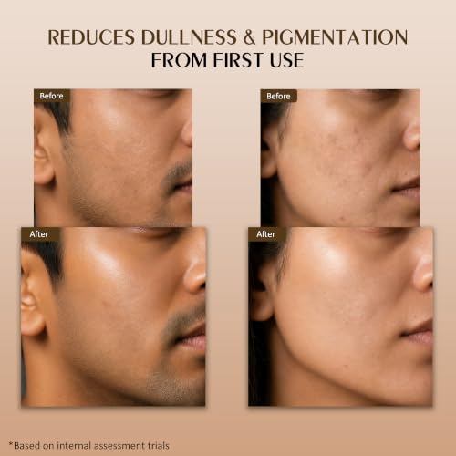 Image of Milk Peel-Off Exfoliating Face Mask | Brightening Skin | Milk Extract, Niacinamide, Aloe Vera, Honey | Dead Skin Removal | Suitable For All Skin Types, 50 ml