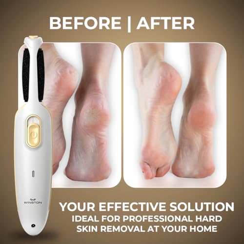 Winston Callus Remover for Feet Electronic Foot Scrubber for Dead Skin, Electric Pedicure Machine for Food Scrubber - 120 Min - Image 6