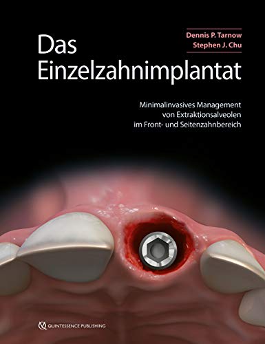 Das Einzelzahnimplantat: Minimalinvasives Management von Extraktionsalveolen im Front- und Seitenzahnbereich ...