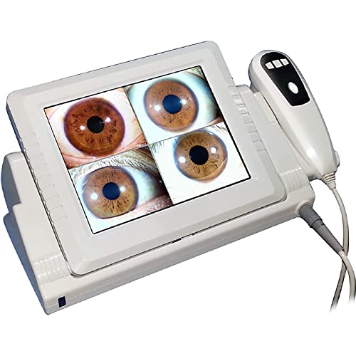 How to freeze your screen