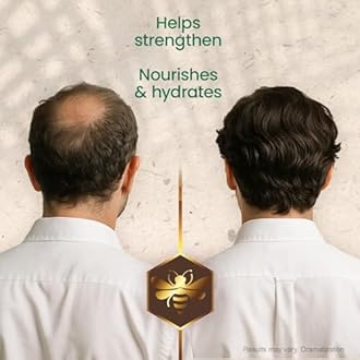 Mexican Herbs Shampoo 14 Oz