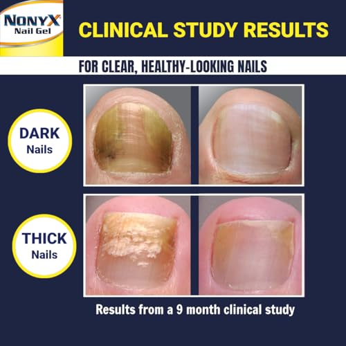 image for NONYX Nail Clarifying Gel | Clinically Proven for Discolored and Damag