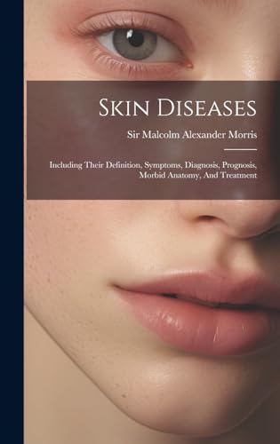 Skin Diseases: Including Their Definition, Symptoms, Diagnosis, Prognosis, Morbid Anatomy, And Treatment