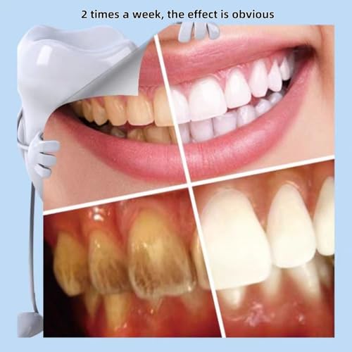 Image of Nano Physical Teeth Cleaning Stick, Teeth Whitening, Cleaning Teeth Smoke Stains, Tartar Stains, Home Oral Care Whitening Teeth Kit, 2+15 Pcs (with 2 Cotton Clips)