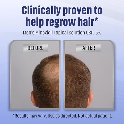 Image of Minoxidil Men's 5% Solution 2oz Tincture Bottle Clinically Proven to Regrow Hair, Topical Solution 5%, Hair Thinning Treatment (2 Fl Oz (Pack Of 3))