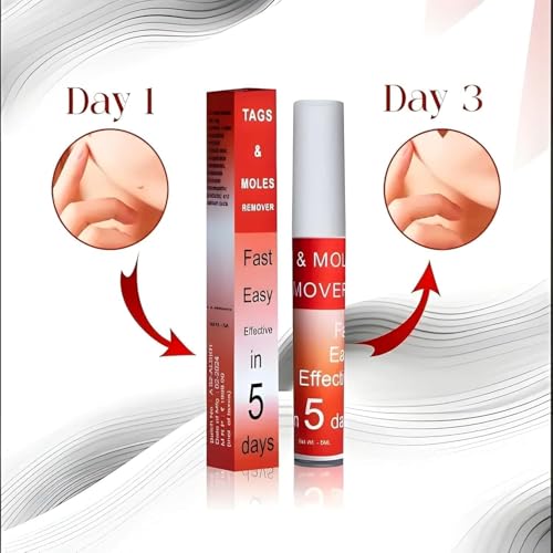 Image of Pack of 2 Wart, Ointment, Skin Tags & Moles Remover For Face & Body | Massa & Ointment Remover For All Skin | Skin Tag Remover - Fast, Easy & Effective Formula for All Skin Type (2 Units)
