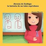 Atresia de Esófago: la historia de un tubo caprichoso