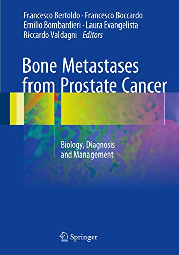 Bone Metastases from Prostate Cancer: Biology, Diagnosis and Management
