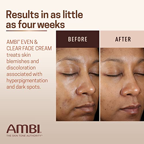 Ambi Even & Clear Fade Cream, Hydroquinone-Free, Hyperpigmentation Treatment, Dark Spot Corrector, Results In As Little As 4 Weeks, Niacinamide, Aloe Vera, Vitamin C, 1 Fl Oz #TOP3
