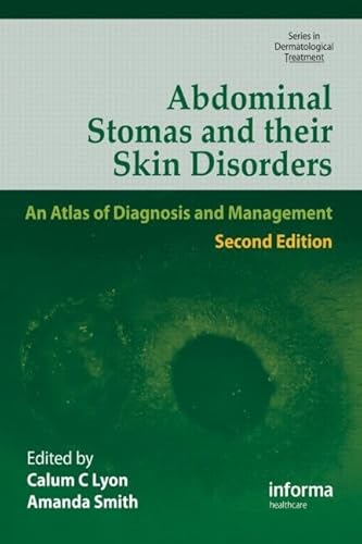 Abdominal Stomas and Their Skin Disorders: An Atlas of Diagnosis and Management (Dermatological Treatment, Band 4)