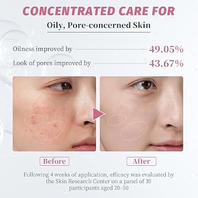Niacinamide Serum 10% + Zinc 2% Brightening Face Serum with Hyaluronic Acid & Arbutin for Nourished, Balanced, Blemish - Prone Skin 30ml / 1 fl oz