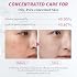 Niacinamide Serum 10% + Zinc 2% Brightening Face Serum with Hyaluronic Acid & Arbutin for Nourished, Balanced, Blemish - Prone Skin 30ml / 1 fl oz