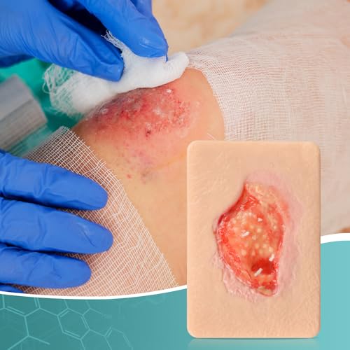 Image of Unhealthy Granulation Wound Simulation Models for Medical Education
