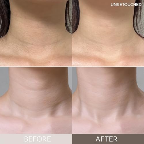 Marshique Máscara de pescoço de colágeno hidrogel para reparo de rugas, previne o envelhecimento tér