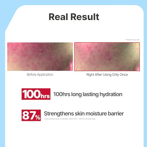 Image of Illiyoon Ceramide Ato Lotion | Lightweight Moisturizer for Dry & Sensitive Skin, Barrier Repair for Face & Body, Mild for Babies, Vegan Certified, Korean Skin Care, 11.83 fl.oz.