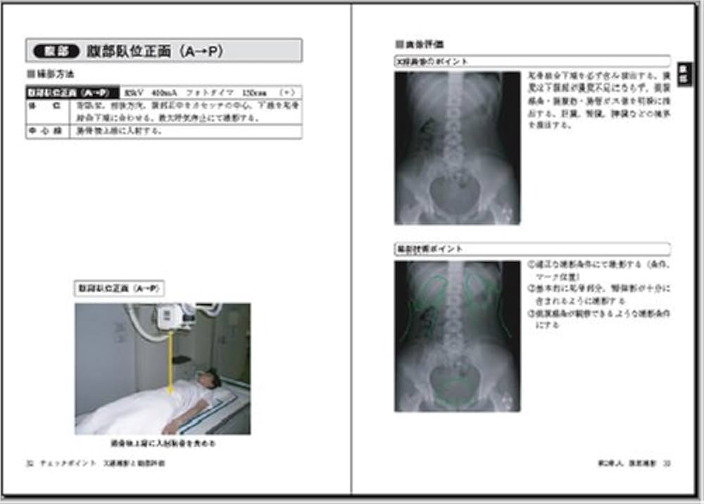 チェックポイントX線撮影と画像評価: 救急医療・当直現場で