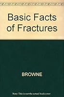 Basic Facts of Fractures 0632008547 Book Cover