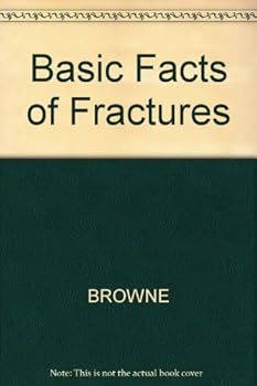 Hardcover Basic Facts of Fractures Book