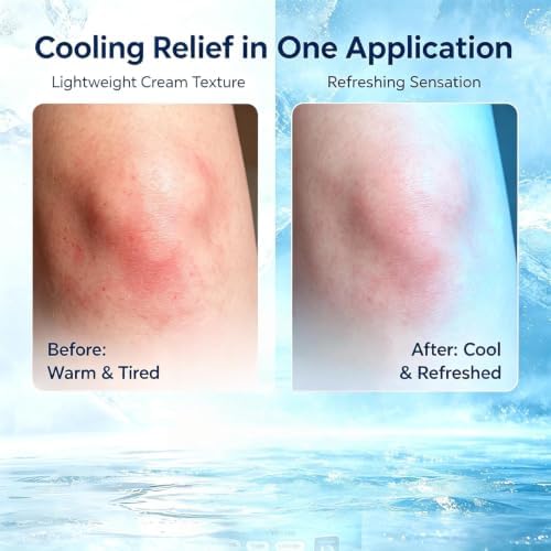 Agelore Magnesium Niacinamide Freeze Cream,Relieve pain,Cooling Formula - 5