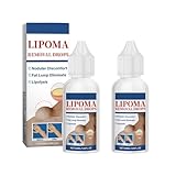 Herbal Lipoma Removal Drops,Lipoma Removal,Lipoma Removal Cream,Creating Perfect Skin,50ML/1.69FL.OZ (2pcs)