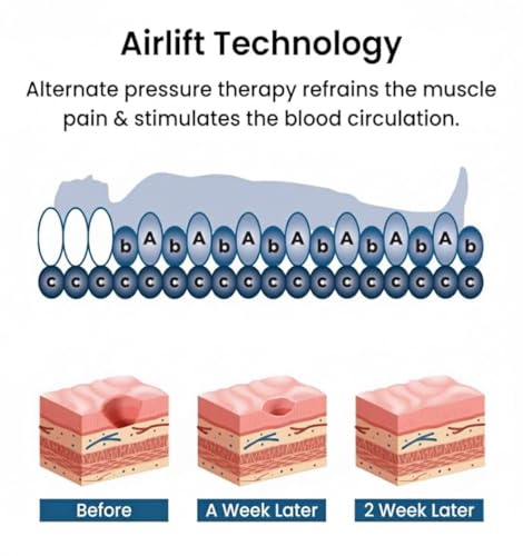 Image of Air Mattress Therapy for Bed Sores Anti-Decubitus|Bubble Mattress| Anti-Bedsore Air Mattress with Compressor Inflatable Air Bed (Blue)
