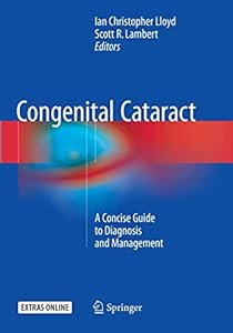 Vedi scheda su Amazon Congenital Cataract: A Concise Guide to Diagnosis and Management