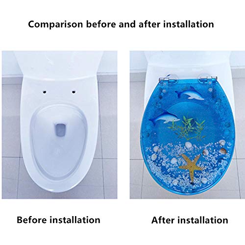 Sedili Wc, Abbassamento automatico, copriwater