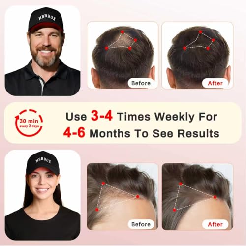 Image of Red Light Hair Growth Cap, 528 Total Light Emitters, Red Light Therapy for Hair,Adjustable Fit,At-Home Sessions for Men & Women, Irradiation Aesthetic