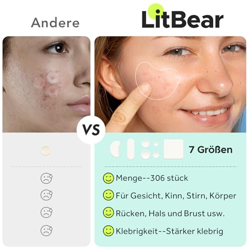 LitBear Große Akne Patches (7 Größen, 306 Patches), Große Pickel Patches, Größe XL für ganzes Gesicht, Stirn, Kinn, Nase, Körper, Rücken, Hals und Brust, Mondförmige, Quadratische Hydrokolloid Patches