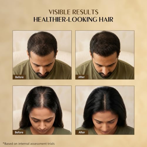 Image of Ayurvedic Hair Oil for Hair Growth | Bhringraj, Amla, Brahmi, Rosemary, Saw Palmetto | Comb Applicator Bottle for Men & Women, 100 ml