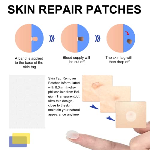 Skin Tag Removal Kit for All Skin Types