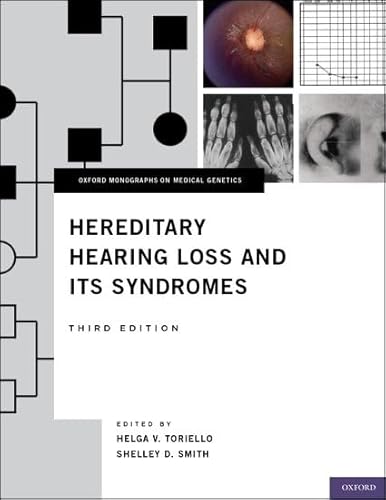 Hereditary Hearing Loss and Its Syndromes (Oxford Monographs on Medical Genetics)