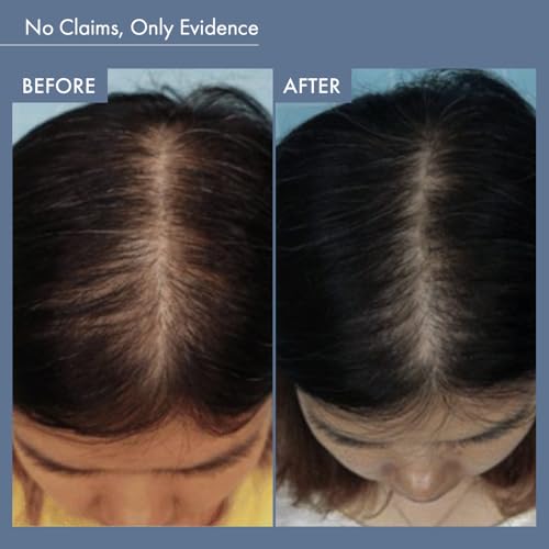 ThriveCo Rosemary Hair Shampoo for Hair Growth|Controls Hair Fall&Boosts Volume|With Pea Peptide,Caffeine,Rice Water,Hyaluronic Acid&Hyaplex |Strengthens Roots|Sulphate&Paraben Free|For Unisex 250 ML - Image 5