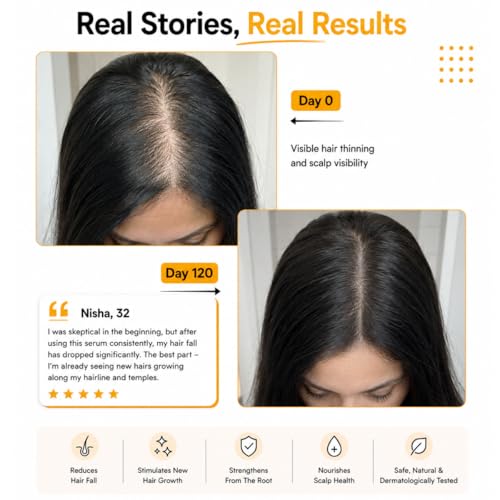 Image of Folliwise Women Hair Vital Serum | Anti-Hair Fall & Hair Growth Support | Redensyl, Procapil, Capilia Longa, Anagain, Exosomes, Caffein | Strengthens Roots, Boosts Density & Reduces Breakage - 30ml