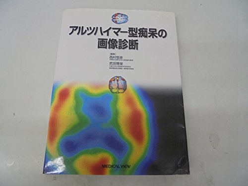 無料電子書籍 pdf アルツハイマー型痴呆の画像診断 バイ