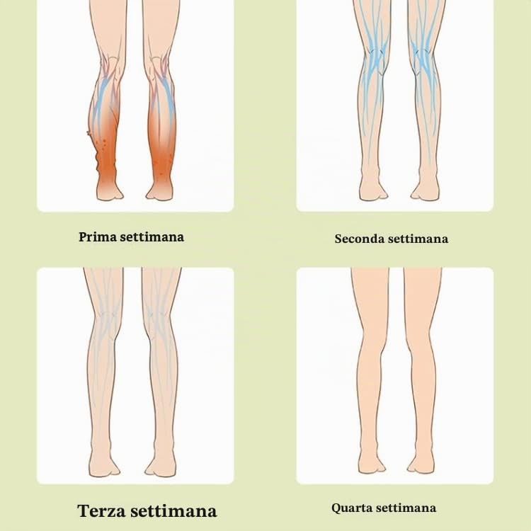 Pressoterapia senza fili presso massaggio polpacci caviglie gambe pesanti gonfie affaticate ristagno dei liquidi cattiva circolazione