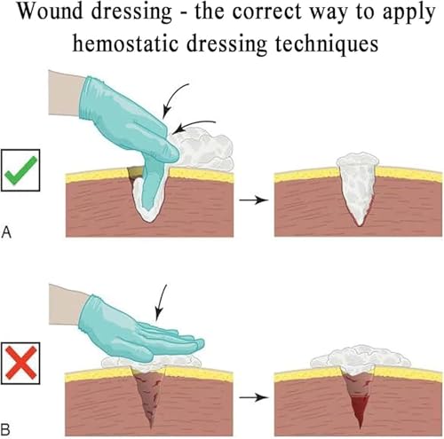 Modèle de simulation de plaie à la jambe pour stopper les erreurs de tamponnement