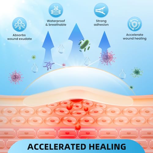 Image of Hydrocolloid Roll Bandages, 2IN x 10FT Extra Large Hydrocolloid Patch with Self-Adhesive, Ultra Absorbent, Cut-to-Size, Flexible & Waterproof for Burn, Blister, Acne Care, First Aid Kit Essential