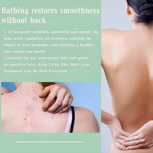 Xidiak 2 Pcs Back Acne Treatment, Back Acne Spray, Salicylic Acid 2 Percent Spray, Body Acne Treatment With Herbal Formula, Back Acne Solution #TOP2