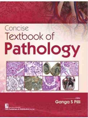 Buy CONCISE TEXTBOOK OF PATHOLOGY (PB 2023) Book Online at Low