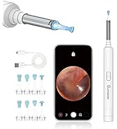 Ohrenschmalz Entferner Otoskop, VITCOCO WiFi Ohrenreiniger Kamera 5MP HD Ohr Kamera IP67 wasserdi...